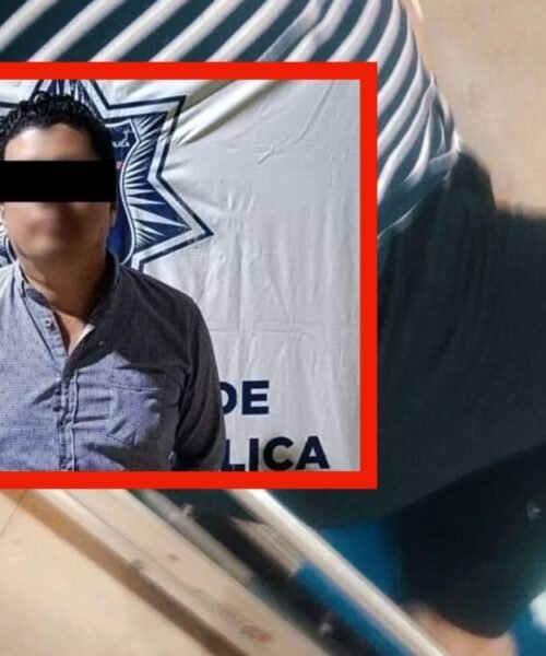 Presunto agente de Ministerio Público de Chiapas golpeó a mujer y ésta pide apoyo para cirugía