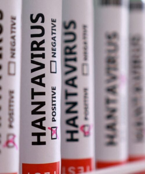 La OMS no excluye que se vean nuevos casos de hantavirus en próximos días o próxima semana